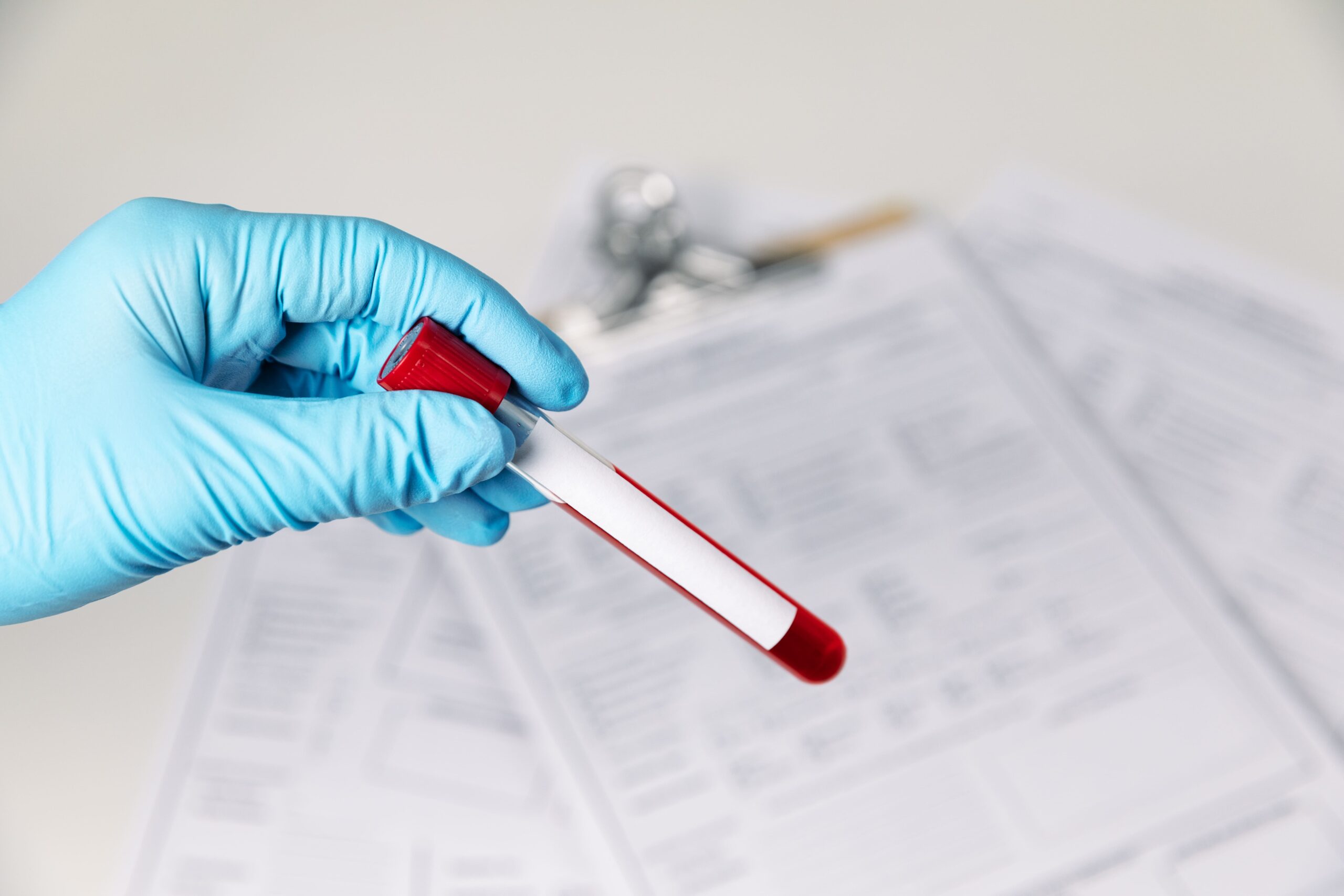 Image arden cholesterol diagnosis