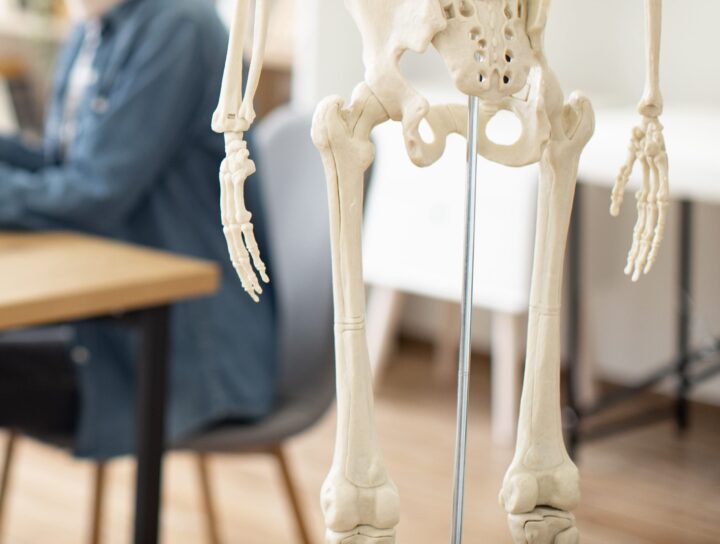 arden-osteomalacia-d