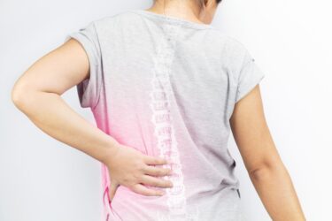 arden-osteoporosis