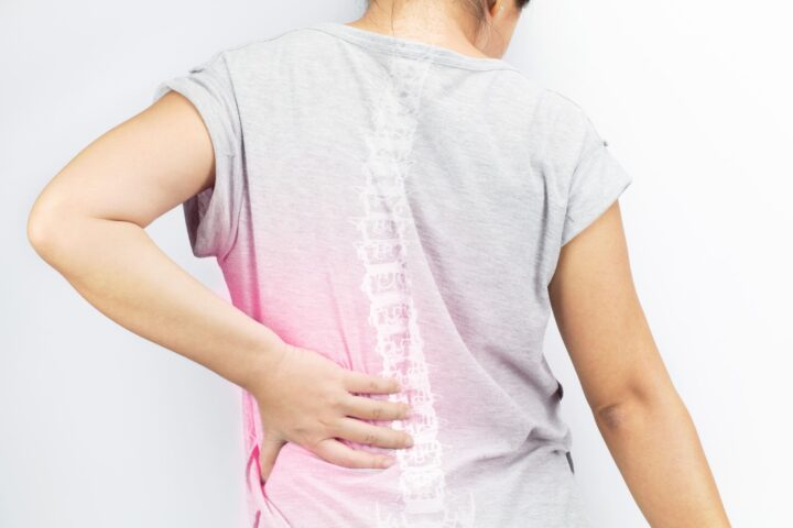 arden-osteoporosis