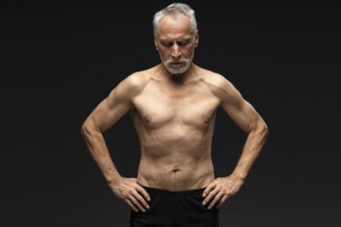 arden-low muscle-sarcopenia