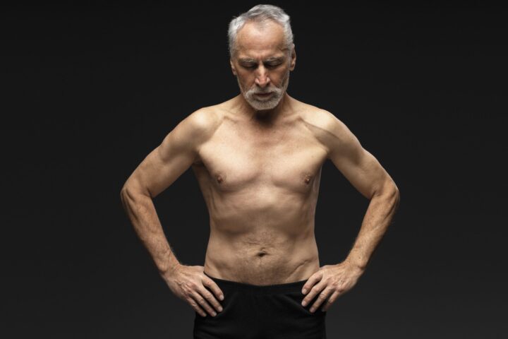 arden-low muscle-sarcopenia